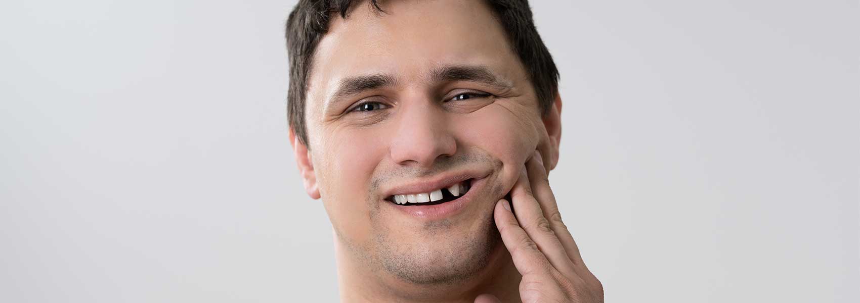 Man smiling with missing tooth